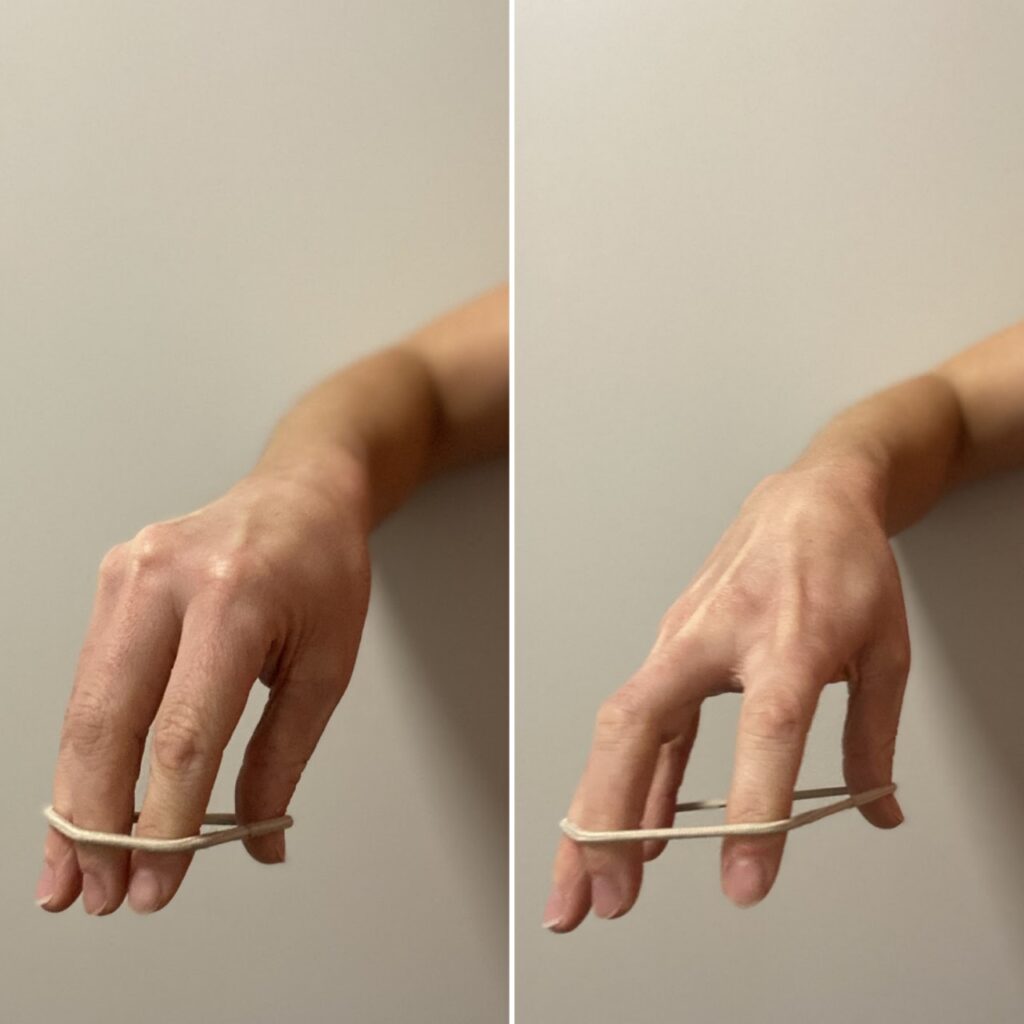 Rubber band finger extension exercise to strengthen finger extensors and prevent rock climbing injuries.